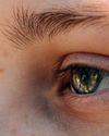 Supervivencia saludable en verano ¿Ojos rojos en verano? No siempre es culpa del cloro Supervivencia saludable en verano ¿Ojos rojos en verano? No siempre es culpa del cloro9