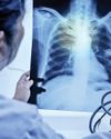 'Dip in TB cases, deaths in India remarkable'