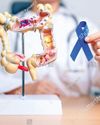 Early-onset colon cancer cases surge globally; lowest in India