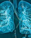 Scientists Develop New Method to Scan Lungs