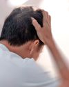 Men 3x More Likely to Die From a Brain Injury: Study