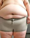 Obesity May Lead to Mental Health Issues: Study43