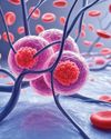 Late Diagnoses, High Costs Driving Blood and Bone Marrow Cancer Cases