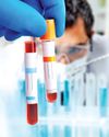 Blood test detects cancer 3 yrs early Blood test detects cancer 3 yrs early