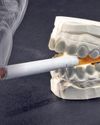 Teeth reveal hidden smoking history41