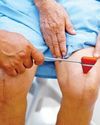 Diabetes May Cause Issues Post Knee Replacement Surgery, States Study43