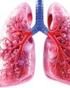 Lung cancer: First trial of antibody drug promising Lung cancer: First trial of antibody drug promising41