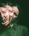 Simple cheek test shows promise for schizophrenia detection45