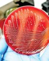 Climate change linked with rise in antibiotic resistance genes in salmonella Climate change linked with rise in antibiotic resistance genes in salmonella41