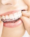 Bracing for the impact of Project Nice Gnashers in the New Town Bracing for the impact of Project Nice Gnashers in the New Town