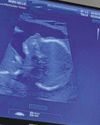 Our little princess already showing incredible strength17