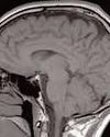 Researchers develop new drug-delivery system to treat brain disorders Researchers develop new drug-delivery system to treat brain disorders