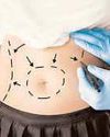 How weight-loss surgery reduces sugar craving How weight-loss surgery reduces sugar craving