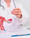 HPV vaccine shows strong impact on cervical cancer risk76
