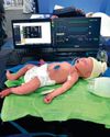 With simulators, we can rapidly train health care workers during pandemics or for new diseases THE WEEK India