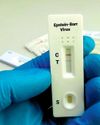 The other Epstein virus The other Epstein virus36