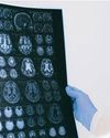 Diet, lifestyle influences chances of age-related brain disorders: Study16