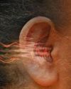 Silencing the Noise Effective Ways to Manage Tinnitus Silencing the Noise Effective Ways to Manage Tinnitus