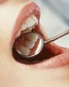 10 Common Dental Problems and How to Prevent Them