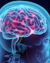 Younger strokes are on the rise in India Younger strokes are on the rise in India17