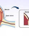 Health Vision