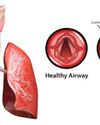 Health Vision