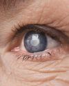 Health Vision