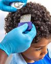 HANDLING HEAD LICE