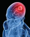 CAUSATIVE FACTORS AND EARLY WARNING SIGNS OF BRAIN TUMOURS CAUSATIVE FACTORS AND EARLY WARNING SIGNS OF BRAIN TUMOURS13
