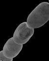 Giant Bacteria- 5000 times bigger than normal