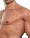 Understanding Monkeypox: Insights and Implications Understanding Monkeypox: Insights and Implications