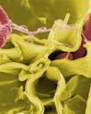 When Antibiotics Backfire: How Antibiotics Fuels Bacterial Resistance9