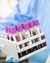 A Simple Blood Test Could Transform Alzheimer's Diagnosis2