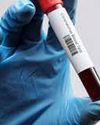 BLOOD TEST WIDENS DOOR TO EARLY CROHN'S DISEASE DIAGNOSIS AND VACCINATION1