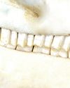 A toothy problem9