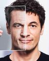 Ozempic’s Facial Transformation Trap4