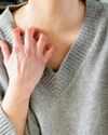 The rash you need to watch for The rash you need to watch for