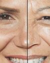 Aging Gracefully - One Wrinkle at a Time Aging Gracefully - One Wrinkle at a Time