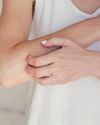 Dermatitis: qué es, por qué aparece y cómo calmarla Dermatitis: qué es, por qué aparece y cómo calmarla