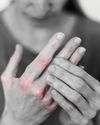 Cracking the Code: How Rheumatologists Solve the Puzzle of Chronic Pain1