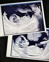 CLINT & ELIZA 'WE'RE PREGNANT!'12