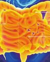 AYUDA EFICAZ CONTRA ESTAS MOLESTIAS DEL COLON IRRITABLE ¿DIARREA?¿DOLOR ABDOMINAL? ¿FLATULENCIA?4