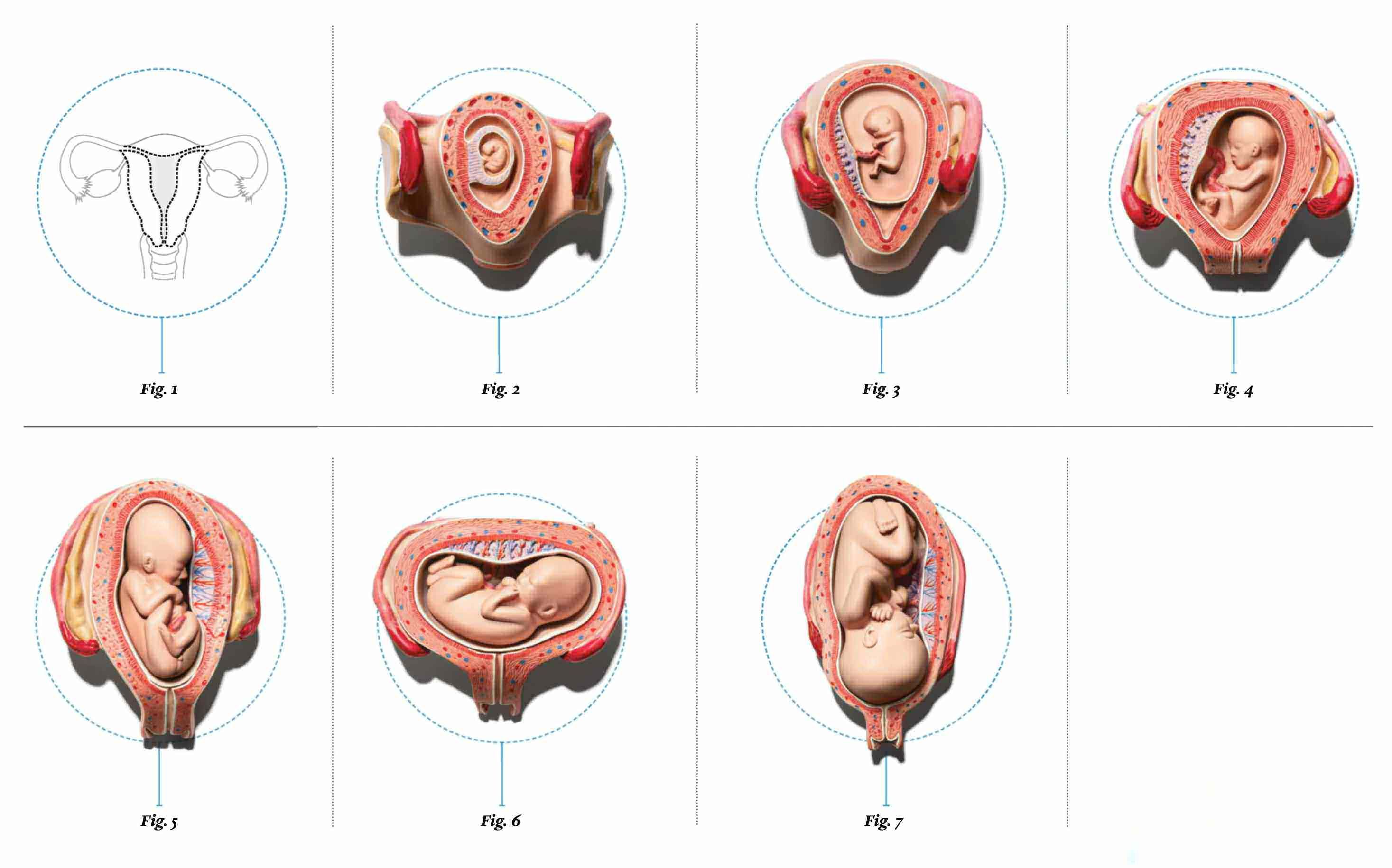 Uterine Transplants Help Women Become Mothers image-result-for-cual-es-la-matriz-de-la-mujer-cambios-en-el-embarazo