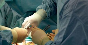 A Cyst Bigger Than Twins!